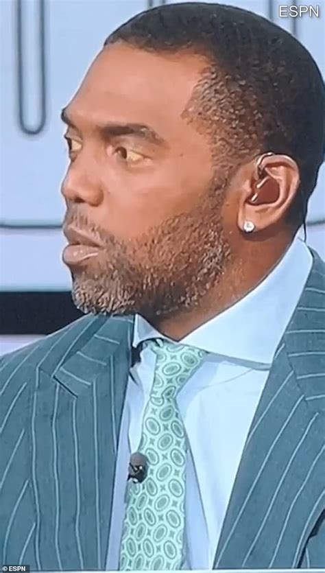 Doctors reveal what could be behind Randy Moss' 'yellow eyes' health ...