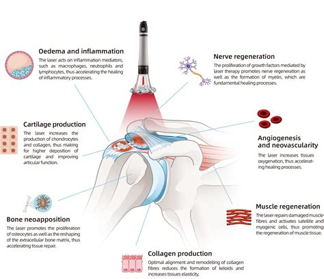 lasertherapy - Leading Manufacturer of Laser Therapy Devices