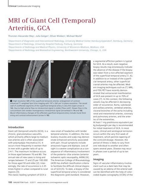 MRI Of Giant Cell Temporal Arteritis GCA Siemens Healthcare