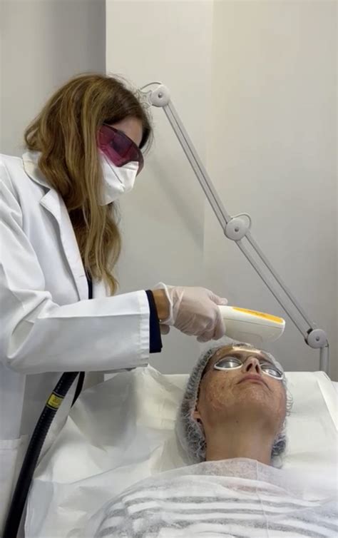 IPL Luz Pulsada Intensa Dra Elena Arnal Clínica dermatológica en