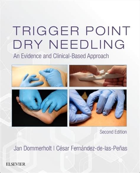 Trigger Point Dry Needling 2nd Edition Trigger Point Dry N Inspire Uplift