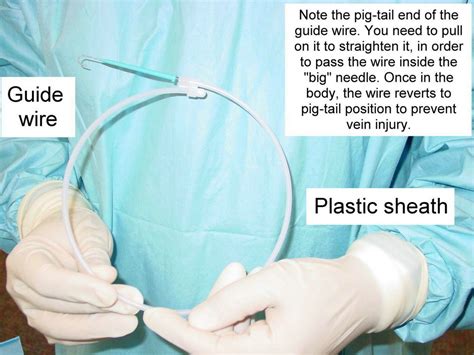 Clinical Notes: Central Line Placement: A Step-by-Step Procedure Guide ...