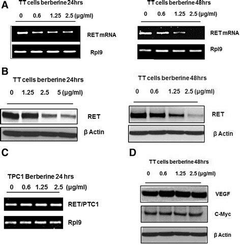 Effect Of Berberine On RET Expression In Both The TT And TPC1 Cell