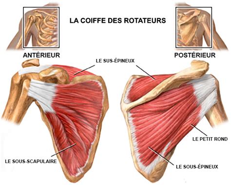 Rupture de la coiffe des rotateurs causes symptômes et traitement