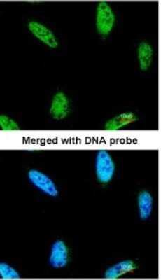 IPMK Antibody NBP1 32250 By Novus Part Of Bio Techne