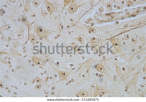 Neurons Cells Spinal Cord Under Microscope Stock Photo (Edit Now) 511685875