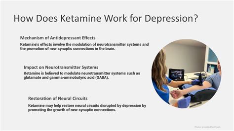 Ppt What To Know About Ketamine Therapy For Depression Powerpoint