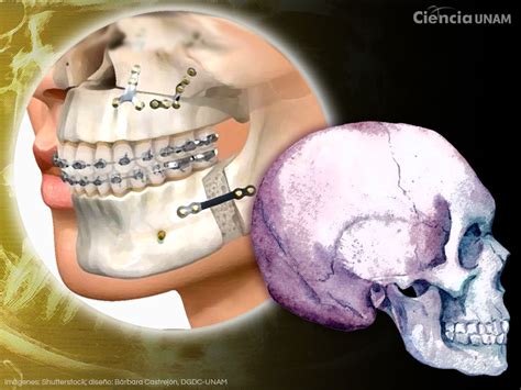 Cirugía maxilofacial en qué casos es necesaria Ciencia UNAM