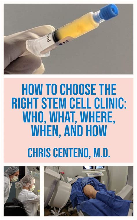 How Long Does Stem Cell Therapy Last For Knees