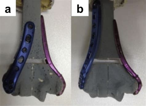 Photographs Of The A Orthogonal B Parallel Plating Samples In Posterior