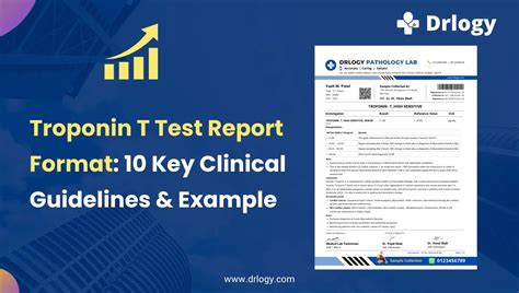 Troponin T Test Report Format Key Clinical Guidelines Example