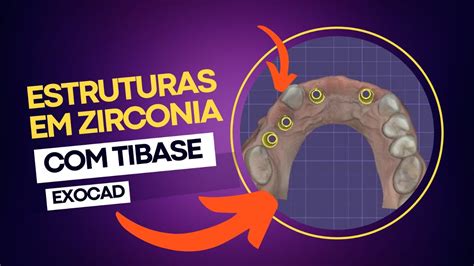 Pequenas Estruturas Em Zirc Nia Tibase Mini Pilar Exocad Youtube