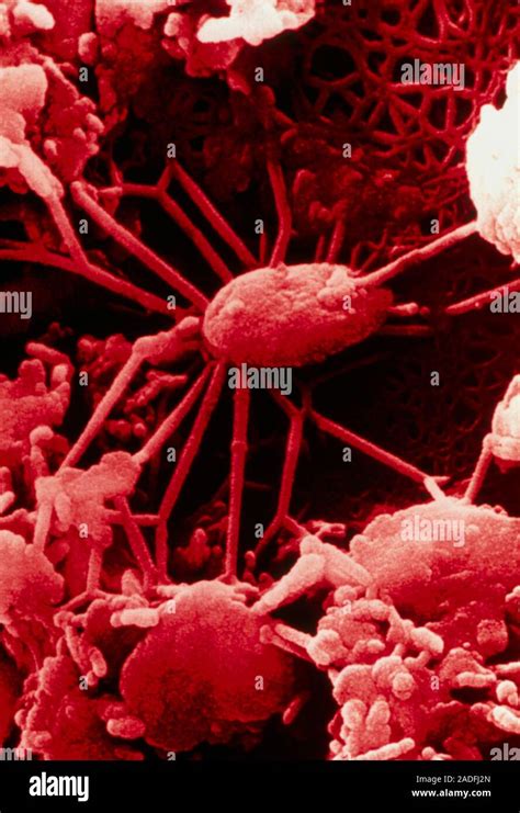 Los Fósiles De Bacterias Color Análisis Micrografía De Electrones Sem