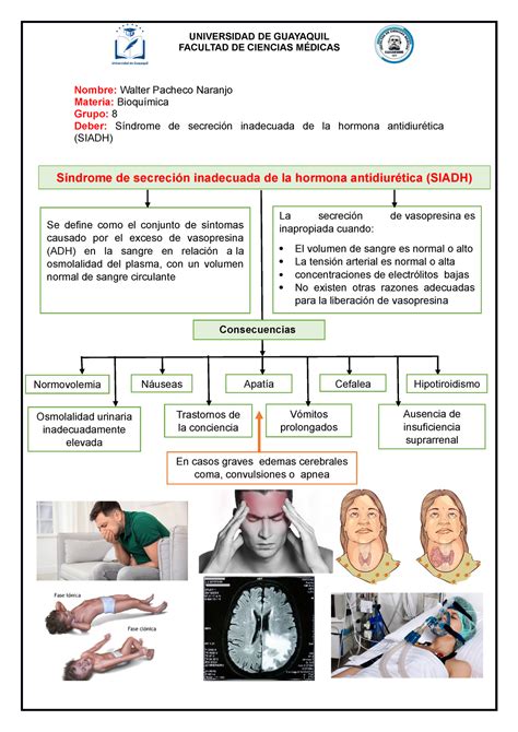 Tarea 2 Síndrome de secreción inadecuada de la hormona antidiurética