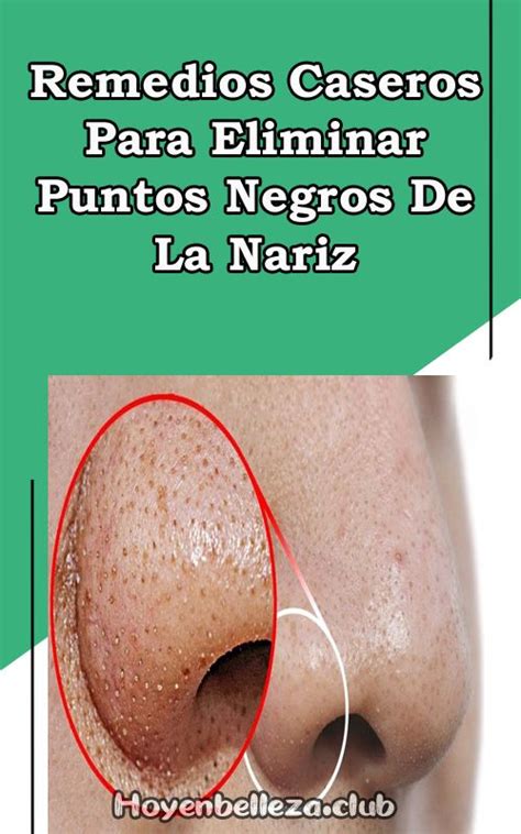 Perceptivo Consciente En Frente De Grasa En La Nariz Puntos Blancos