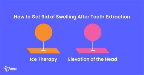 Swelling After Tooth Extraction Causes Treatments And Essential Tips