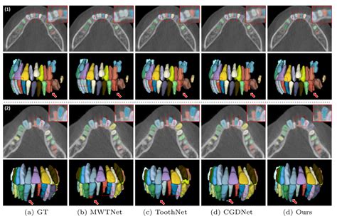 Hierarchical Morphology Guided Tooth Instance Segmentation From Cbct Images