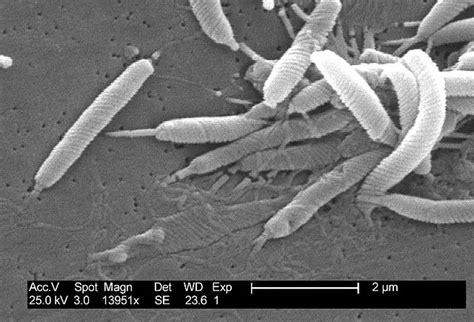 Eubacteria - Examples, Characteristics, Vs Archaebacteria