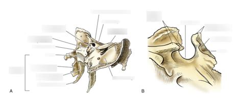 Oblique Aspect Of Upper And Lateroposterior Aspects Of The Sphenoid