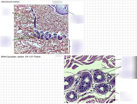 Lab D - Sudoriferous Glands (caucasian skin) Diagram | Quizlet