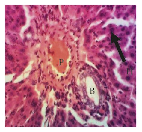 Photomicrographs Of Liver Tissue Sections Of The Experimental Groups