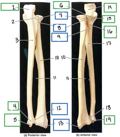 Ulnar And Radial Landmarks Diagram Quizlet