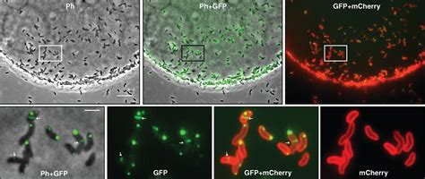 The Type Vi Secretion System Of Vibrio Cholerae Fosters Horizontal Gene