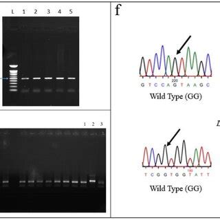 A Photograph Showing Electropherograms Of PCR Products Of ERBB4