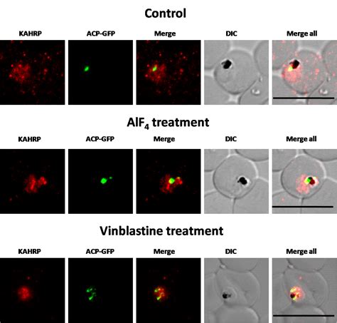 Membrane And Luminal Proteins Reach The Apicoplast By Different Trafficking Pathways In The