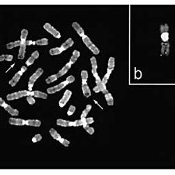 Chromosomal Localization Of Mouse Aqp Genomic Locus A A Murine