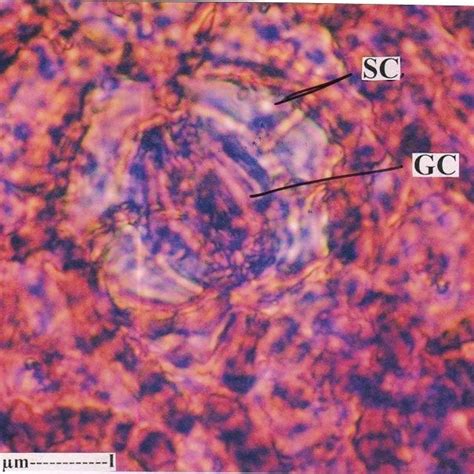 Fig. no. 16: A portion of the sclereid enlarged. (Scl-Sclereids ...