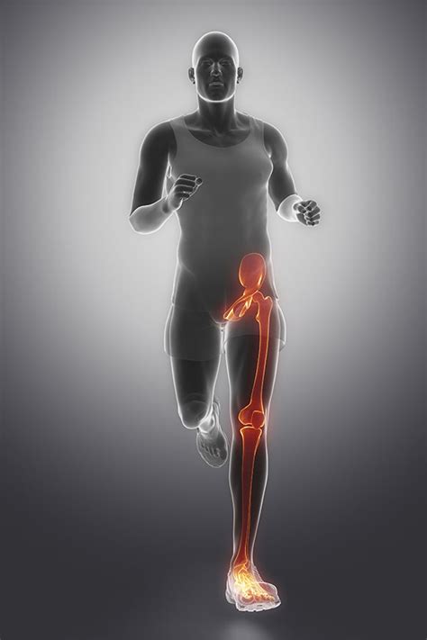 Short Leg Causing Hip Pain