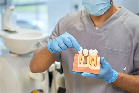 How Do Dental Implants Stay In Place Modern Day Smiles