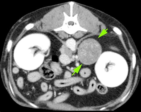 What Does A Dog Ct Scan Show