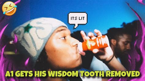 A Gets His Wisdom Tooth Removed Youtube