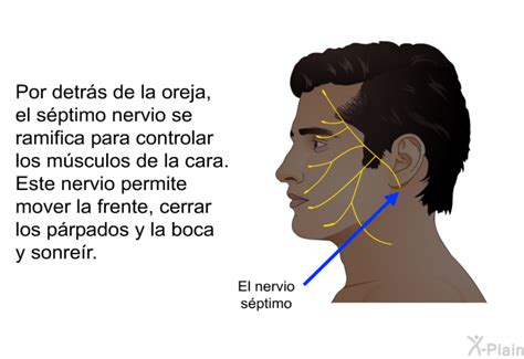 Patedu Par Lisis Facial De Bell