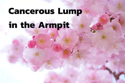 Cancerous Lump in the Armpit - Health Advisor