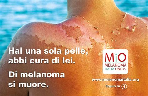 Maggio Mese Della Prevenzione Abbi Cura Della Tua Pelle Di Melanoma