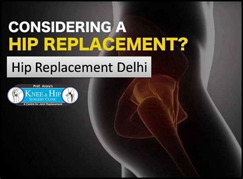 Hip Replacement Delhi Hip Replacement Joint Replacement Hip Surgery