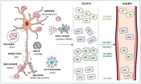 《柳叶刀神经》 阿尔茨海默病的血液生物标志物：如何走向临床实践？财经头条