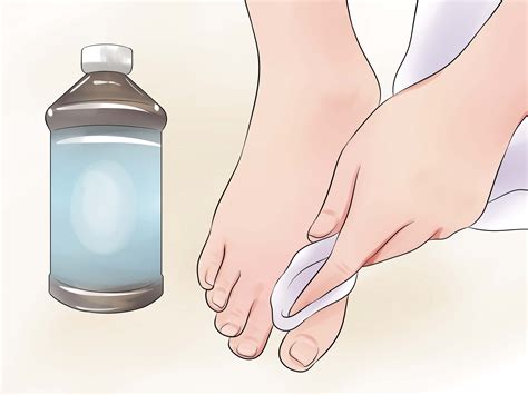 How to Prevent Smelly Feet (with Pictures) - wikiHow