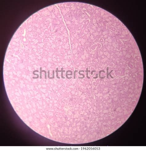 Submaxillary Submandibular Gland Mixed Salivary Gland Foto Stock