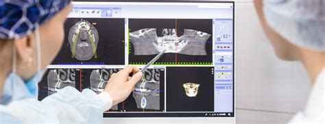 Dental Cbct Scan What Is It Why You Need One