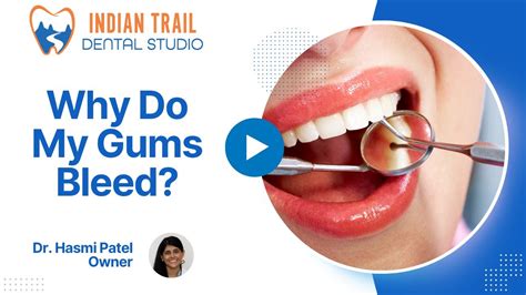 Why Do My Gums Bleed When I Brush Indian Trail Dental Youtube