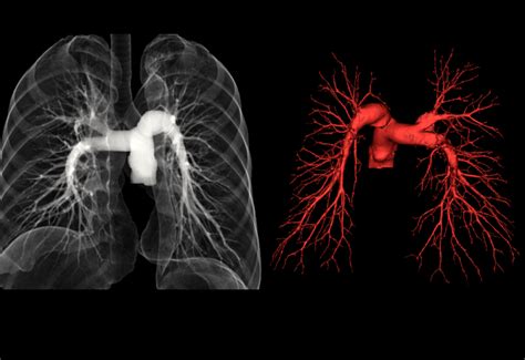 BodyScans MRI CT Scan Ultrasound ECHO X Ray In Indore