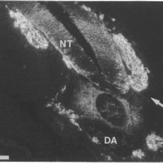 Fluorescence Photomicrographs Of Transverse Cryostat Sections Through