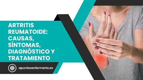 Artritis Reumatoide Causas Síntomas Diagnóstico Y Tratamiento