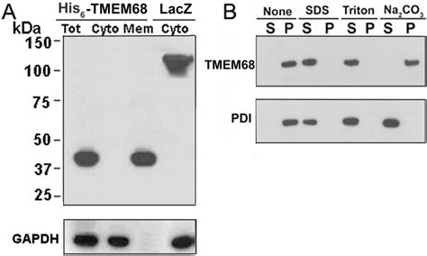 Membrane Association Of Tmem A Cellular Post Nuclear Supernatants