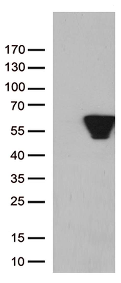 Vim Monoclonal Antibody Oti B Truemab Origene L