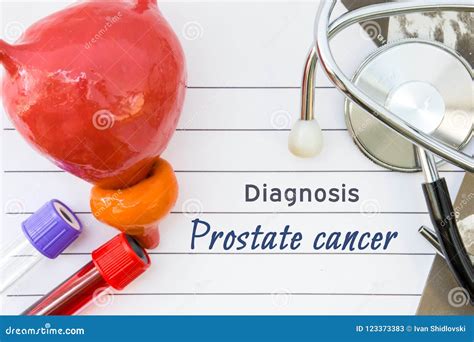 Diagnosis of Prostate Cancer. Medical Concept Picture of Diagnosis ...